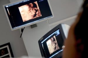 Birth Injury Lawyers Alliance Ultrasound of a Fetus