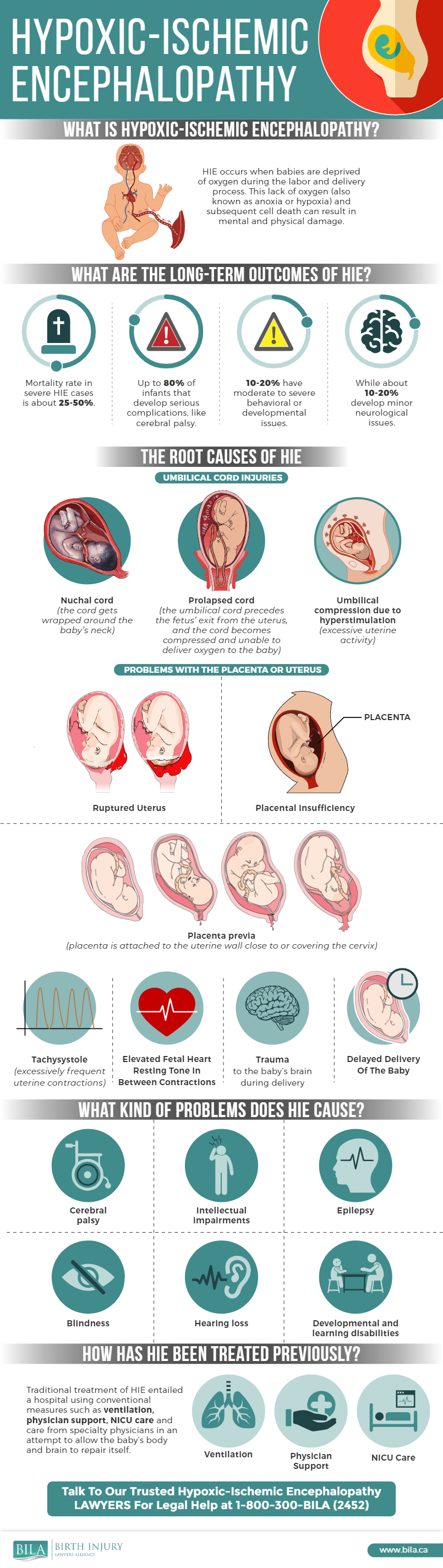 Hypoxic Ischemic Encephalopathy in Newborns