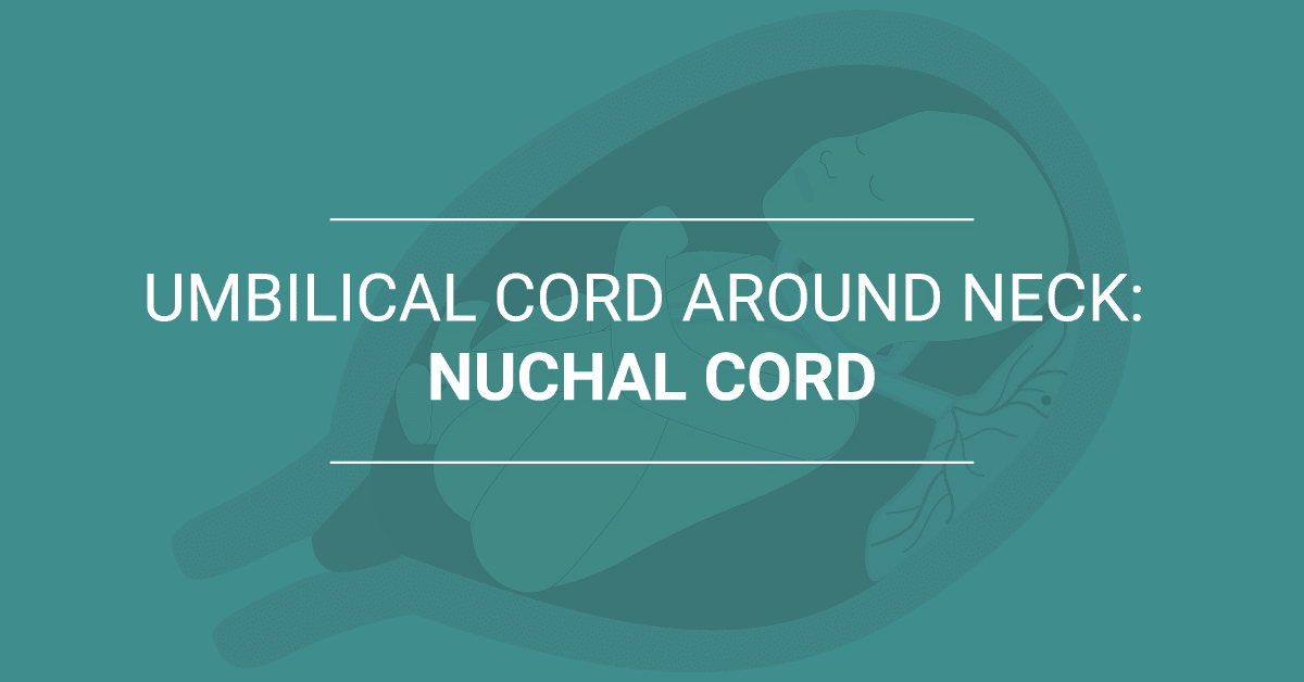 Umbilical Cord Around Neck