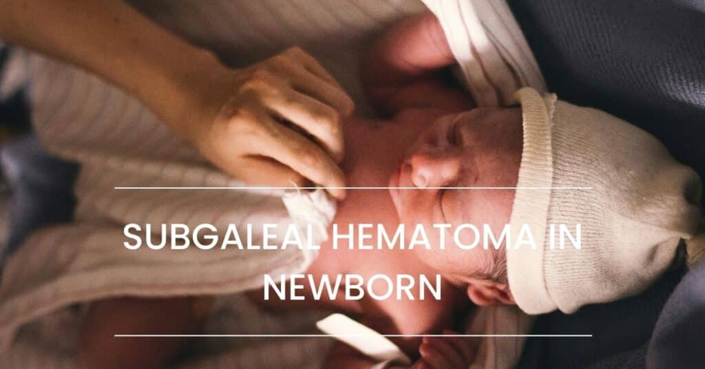 Subgaleal Hematoma in Newborn